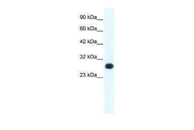 Western Blot: RAP30 Antibody [NBP3-17980]