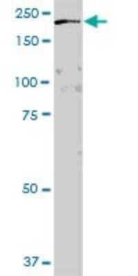 Western Blot: RAP6 Antibody [H00026130-B01P]