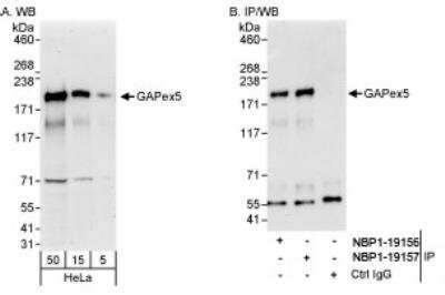 Western Blot: RAP6 Antibody [NBP1-19156]