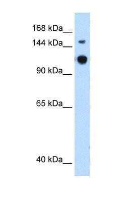 Western Blot: RAP6 Antibody [NBP1-53013]