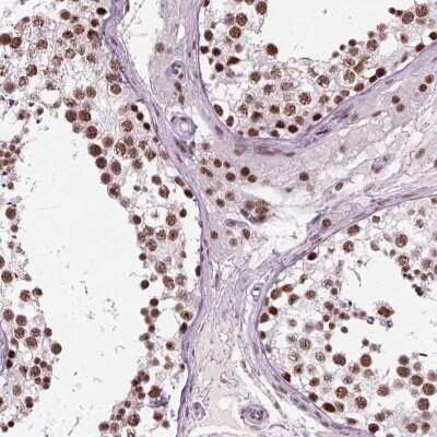 Immunohistochemistry: RAP74 Antibody [NBP3-17977]