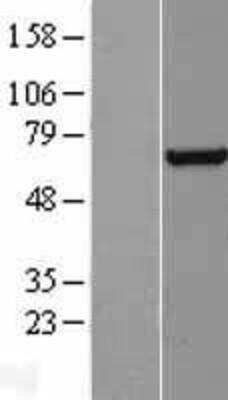 Western Blot: RAP74 Overexpression Lysate [NBP3-17994]