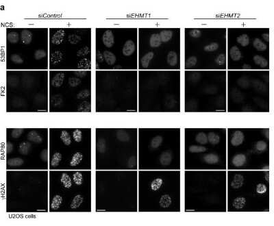Immunocytochemistry/ Immunofluorescence: RAP80 Antibody [NBP1-87156]