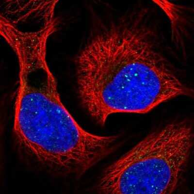 Immunocytochemistry/ Immunofluorescence: RAP80 Antibody [NBP1-87157]
