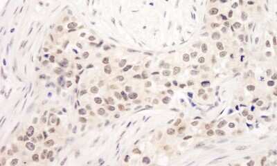 Immunohistochemistry: RAP80 Antibody [NB100-2347]