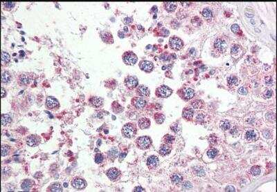 Immunohistochemistry-Paraffin: RAP80 Antibody [NBP1-45228]