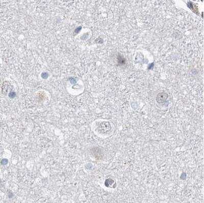 Immunohistochemistry-Paraffin: RAP80 Antibody [NBP1-87156]