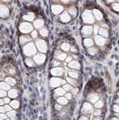 Immunohistochemistry-Paraffin: RAP80 Antibody [NBP1-87156]