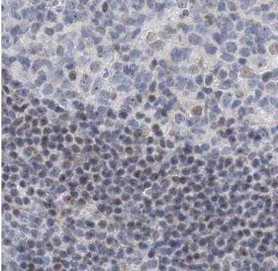Immunohistochemistry-Paraffin: RAP80 Antibody [NBP1-87156]