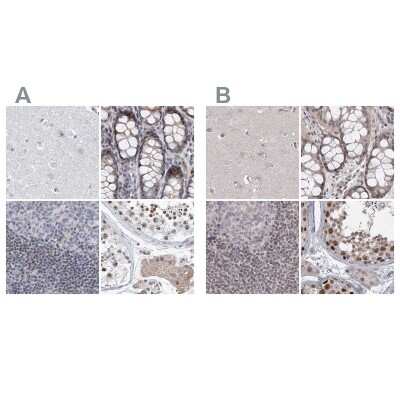 Immunohistochemistry-Paraffin: RAP80 Antibody [NBP1-87156]