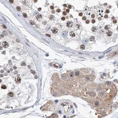 Immunohistochemistry-Paraffin: RAP80 Antibody [NBP1-87156]