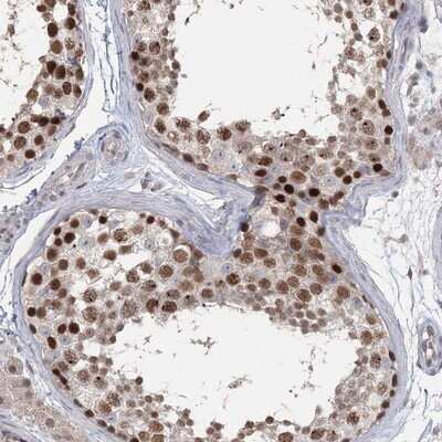 Immunohistochemistry-Paraffin: RAP80 Antibody [NBP1-87157]