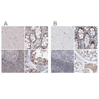 Immunohistochemistry-Paraffin: RAP80 Antibody [NBP1-87157]