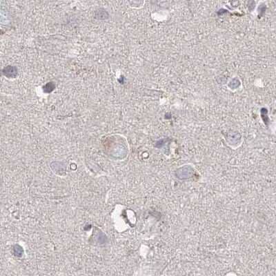 Immunohistochemistry-Paraffin: RAP80 Antibody [NBP1-87157]