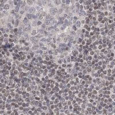 Immunohistochemistry-Paraffin: RAP80 Antibody [NBP1-87157]