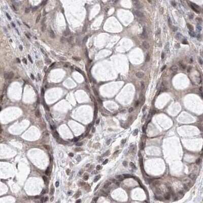 Immunohistochemistry-Paraffin: RAP80 Antibody [NBP1-87157]