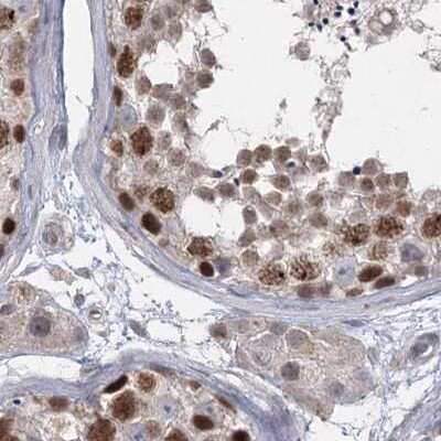Immunohistochemistry-Paraffin: RAP80 Antibody [NBP1-87157]