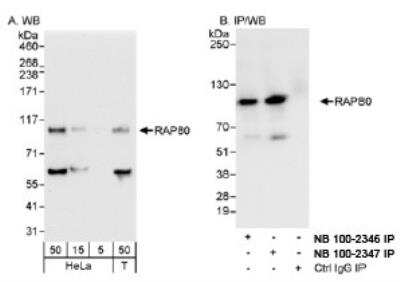 Western Blot: RAP80 Antibody [NB100-2347]