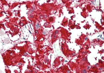 Immunohistochemistry-Paraffin: RAPGEF2 Antibody [NBP2-88124]