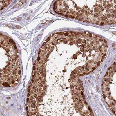 Immunohistochemistry: RAPGEF3 Antibody [NBP2-32615]