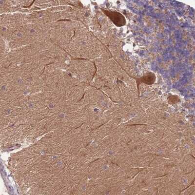 Immunohistochemistry: RAPGEF3 Antibody [NBP2-33395]