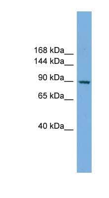 Western Blot: RAPGEF3 Antibody [NBP1-57044]