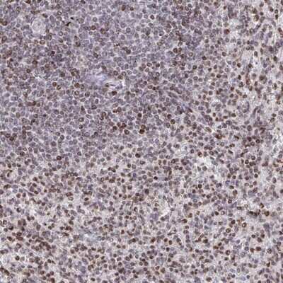 Immunohistochemistry: RAPGEF5 Antibody [NBP2-38835]