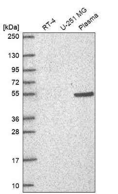 Western Blot: RAPGEF5 Antibody [NBP2-57362]