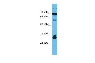 Western Blot: RAPGEFL1 Antibody [NBP2-86762]