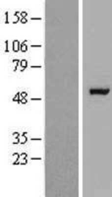 Western Blot: RAPGEFL1 Overexpression Lysate [NBP2-07050]