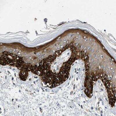 Immunohistochemistry: RAPH1 Antibody [NBP1-90860]