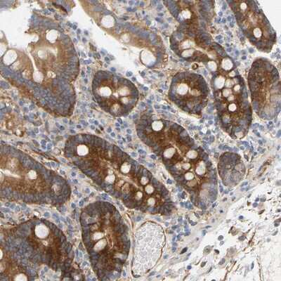 Immunohistochemistry-Paraffin: RAPH1 Antibody [NBP1-90859]