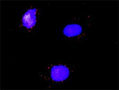 Proximity Ligation Assay: RAR alpha/NR1B1 Antibody (1C10) [H00005914-M02]