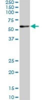 Western Blot: RAR alpha/NR1B1 Antibody (1C10) [H00005914-M02]