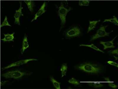 Immunocytochemistry/ Immunofluorescence: RAR alpha/NR1B1 Antibody (2C3) [H00005914-M09]