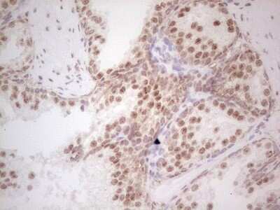 Immunohistochemistry: RAR alpha/NR1B1 Antibody (OTI2C3) [NBP2-45516]