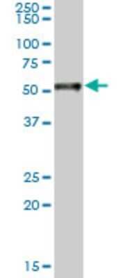 Western Blot: RAR alpha/NR1B1 Antibody (2C3) [H00005914-M09]