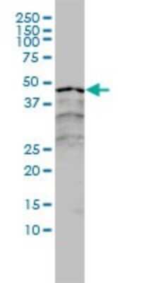 Western Blot: RAR alpha/NR1B1 Antibody (2C9-1F8) [H00005914-M01]