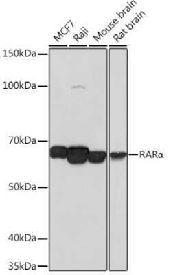 Western Blot: RAR alpha/NR1B1 Antibody (9C7R10) [NBP3-15770]