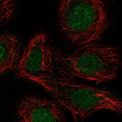 Immunocytochemistry/ Immunofluorescence: RAR alpha/NR1B1 Antibody [NBP2-58082]