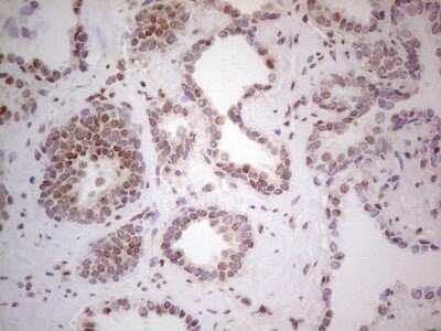 Immunohistochemistry: RAR alpha/NR1B1 Antibody (OTI2C3) - Azide and BSA Free [NBP2-73802]
