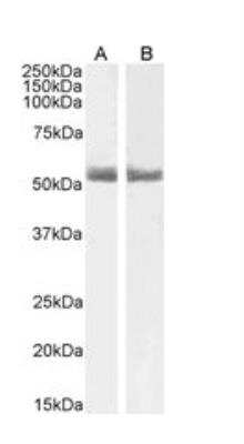 Western Blot: RAR alpha/NR1B1 Antibody [NB300-969]