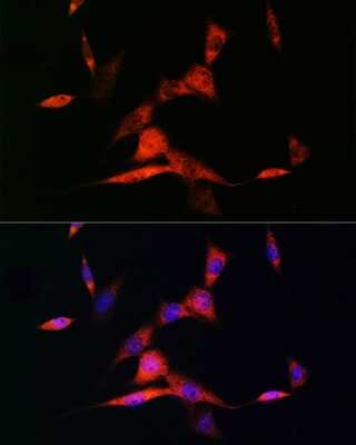 Immunocytochemistry/ Immunofluorescence: RAR beta/NR1B2 Antibody (6D5V4) [NBP3-16428]