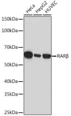 Western Blot: RAR beta/NR1B2 Antibody (6D5V4) [NBP3-16428]