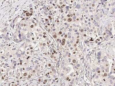 Immunohistochemistry-Paraffin: RAR beta/NR1B2 Antibody [NBP2-98903]
