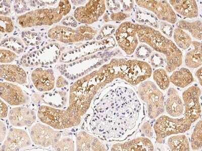 Immunohistochemistry-Paraffin: RAR beta/NR1B2 Antibody [NBP2-98903]