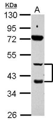 Western Blot: RAR beta/NR1B2 Antibody [NBP2-20129]