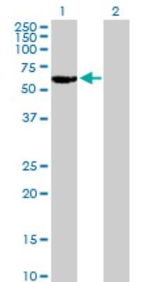 Western Blot: RAR gamma/NR1B3 Antibody [H00005916-B01P]