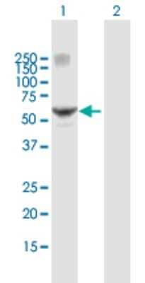 Western Blot: RAR gamma/NR1B3 Antibody [H00005916-B02P]