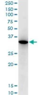 Western Blot: RARRES1 Antibody (2E2) [H00005918-M06]